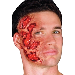 3-D Burns Prosthetic Application