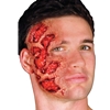 3-D Burns Prosthetic Application