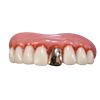 Billy Bob Teeth Full Grill Gold